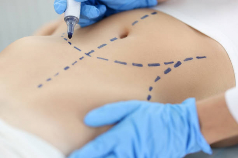Clinica Que Faz Aplicação de Enzimas para Emagrecer ABCD - Aplicação de Enzimas na Papada Clinica Que Faz Aplicação de Enzimas para Emagrecer ABCD - Aplicação de Enzimas na Papada