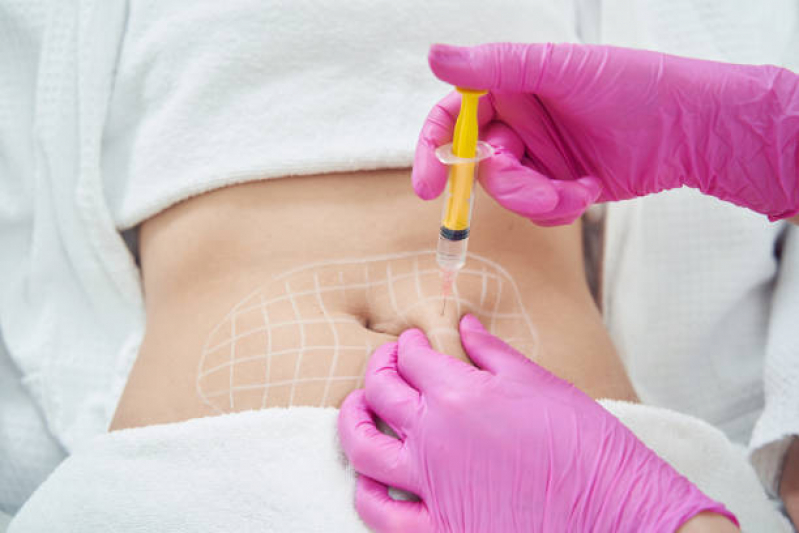 Clinica Que Faz Aplicação de Enzimas para Gordura Cajamar - Aplicação de Enzimas na Papada Clinica Que Faz Aplicação de Enzimas para Gordura Cajamar - Aplicação de Enzimas na Papada