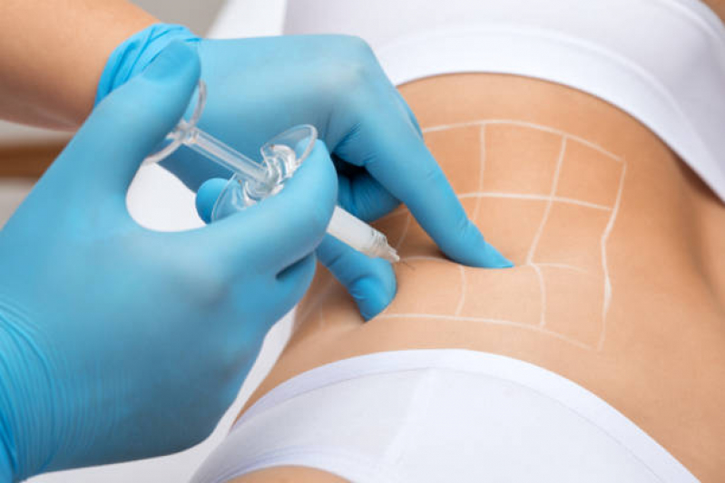 Enzimas para Emagrecer Intramuscular Agendar São Francisco - Aplicação de Enzimas na Papada Enzimas para Emagrecer Intramuscular Agendar São Francisco - Aplicação de Enzimas na Papada