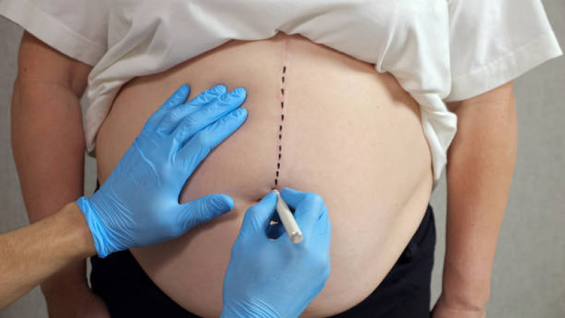 Enzimas para Emagrecer Intramuscular Marcar Alto da Boa Vista - Aplicação de Enzimas na Papada Enzimas para Emagrecer Intramuscular Marcar Alto da Boa Vista - Aplicação de Enzimas na Papada