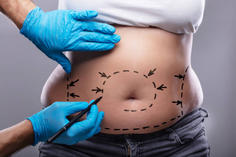 Procedimento com Enzima Intramuscular para Emagrecimento Mirandópolis e Saúde - Aplicação de Enzimas na Papada Procedimento com Enzima Intramuscular para Emagrecimento Mirandópolis e Saúde - Aplicação de Enzimas na Papada