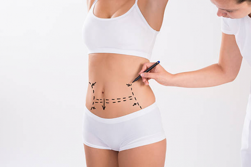 Procedimento com Enzimas de Emagrecimento Intramuscular Pirajussara - Aplicação de Enzimas de Emagrecimento Procedimento com Enzimas de Emagrecimento Intramuscular Pirajussara - Aplicação de Enzimas de Emagrecimento