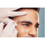 clinica de preenchimento maxilar masculino Vila Joaniza