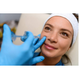 aplicação de botox na boca preço Engenho Velho