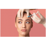 aplicação de botox na testa preço Jardim Ângela,