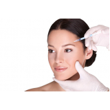 aplicação de botox na testa Berrini