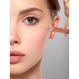 aplicação de botox no rosto valor Jardim Edi