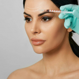 aplicação de botox no rosto Santo Amaro