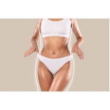 clinica de lipo enzimática no braço Americanópolis