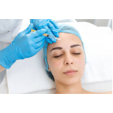 clinica de peeling quimico para estrias Pedreira