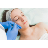 clinica de peeling químico Moema