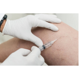 clinica de ventosaterapia perto de mim Pedreira