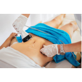 clinica especializada em drenagem linfática no abdômen Ibirapuera