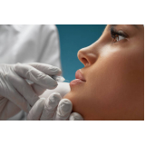 clinica que faz microagulhamento labial Moema