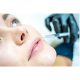 clinica que faz micropigmentação labial natural Aclimação