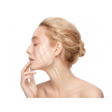 clinica que faz peeling quimico para manchas Zona Sul