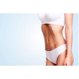 lipo enzimática no rosto Vila Mariana