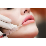 microagulhamento labial marcar Jabaquara