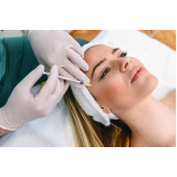 peeling químico profissional valor Engenho Velho