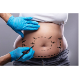 procedimento com enzima intramuscular para emagrecimento Jardim Edi